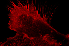 LM11 Hairy Pancreatic Cancer Cell